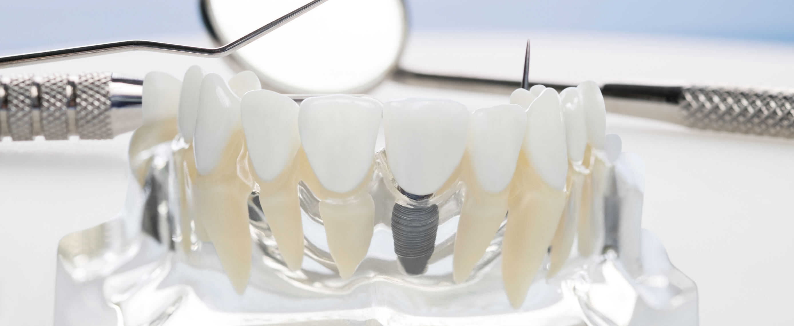 Implantology
